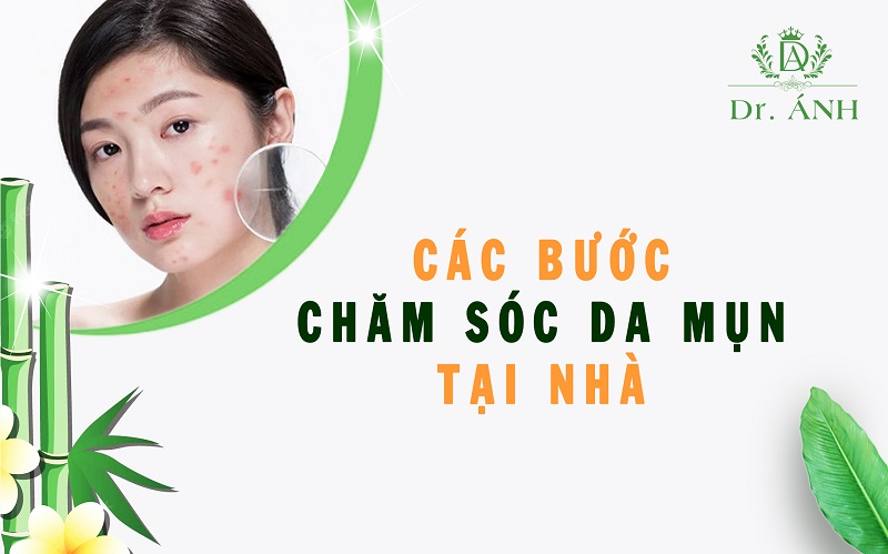 Các bước chăm sóc da mụn chuẩn spa tại nhà