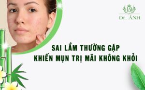 Những sai lầm thường gặp khiến mụn trị mãi không khỏi