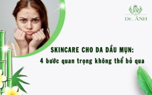 Skincare cho da dầu mụn: 4 bước quan trọng không thể bỏ qua